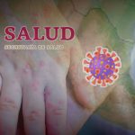 Secretaría de Salud confirma brotes de sarampión en todo México